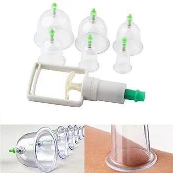 6-Piece Hijama Cupping Therapy Set – Vacuum Suction Massage Cups for Pain Relief, Relaxation & Muscle Recovery - Chaudhary Brand Store 