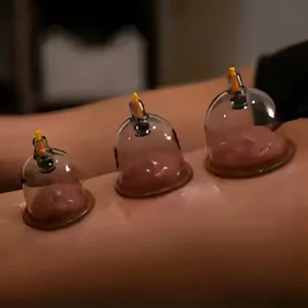 6-Piece Hijama Cupping Therapy Set – Vacuum Suction Massage Cups for Pain Relief, Relaxation & Muscle Recovery - Chaudhary Brand Store 