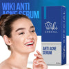 Wiki Special Anti Acne Serum 30ml | Clears Acne & Soothes Skin