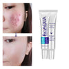 Acne Scar Removal Rejuvenation Cream (original) - Chaudhary Brand Store 