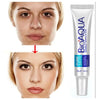 Acne Scar Removal Rejuvenation Cream (original) - Chaudhary Brand Store 