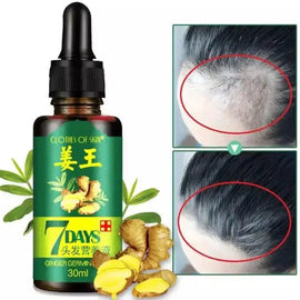 Hair Growth Serum - 30ml - Chaudhary Brand Store 
