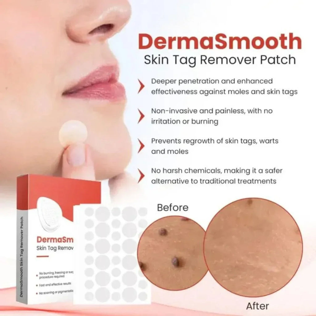 DermaSmooth Skin Tag Remover Patch | Fast, Painless Skin Tag & Mole Removal (144 Patches)