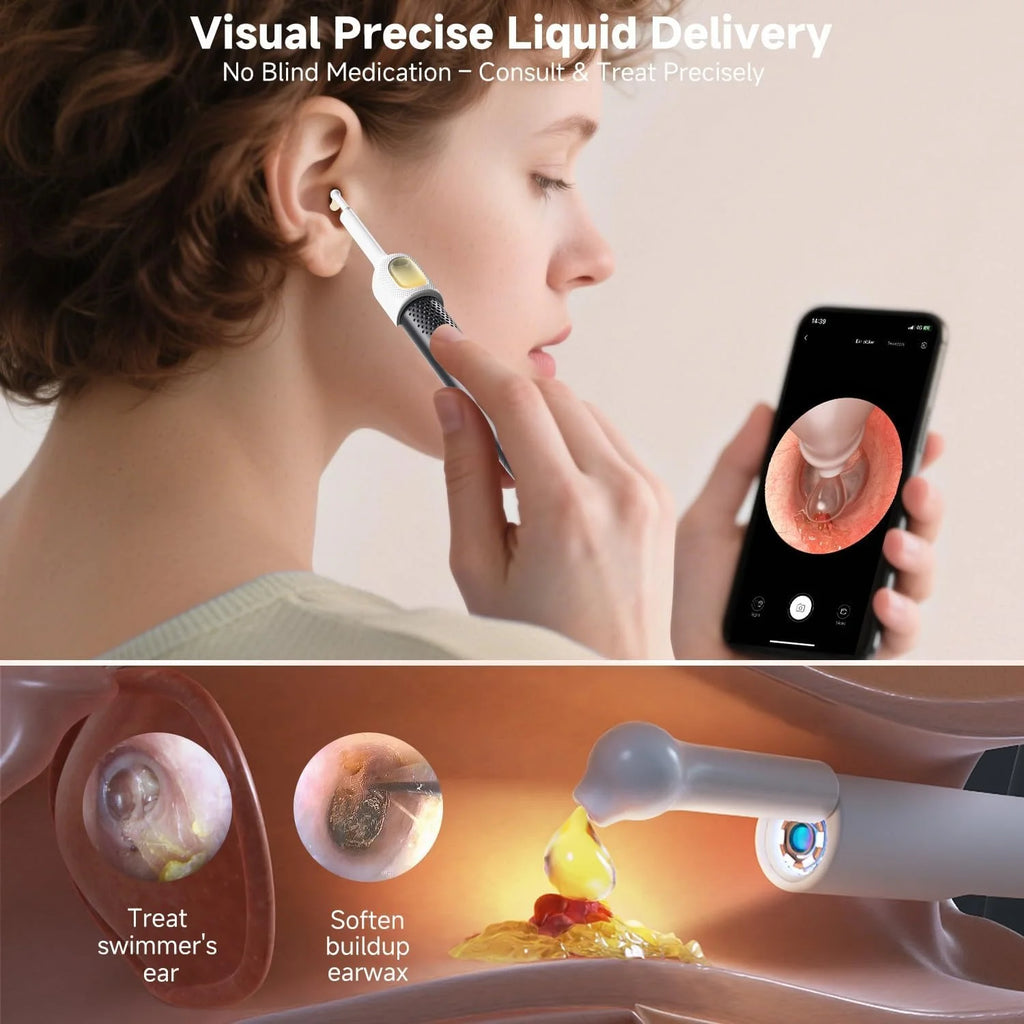 Smart Wireless Ear Camera Cleaner Rechargeable Kit