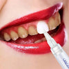 Teeth Whitening Pen - Chaudhary Brand Store 