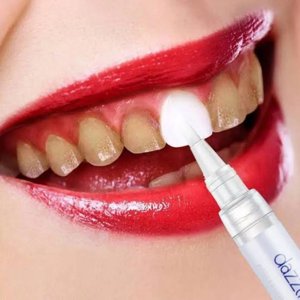 Teeth Whitening Pen - Chaudhary Brand Store 