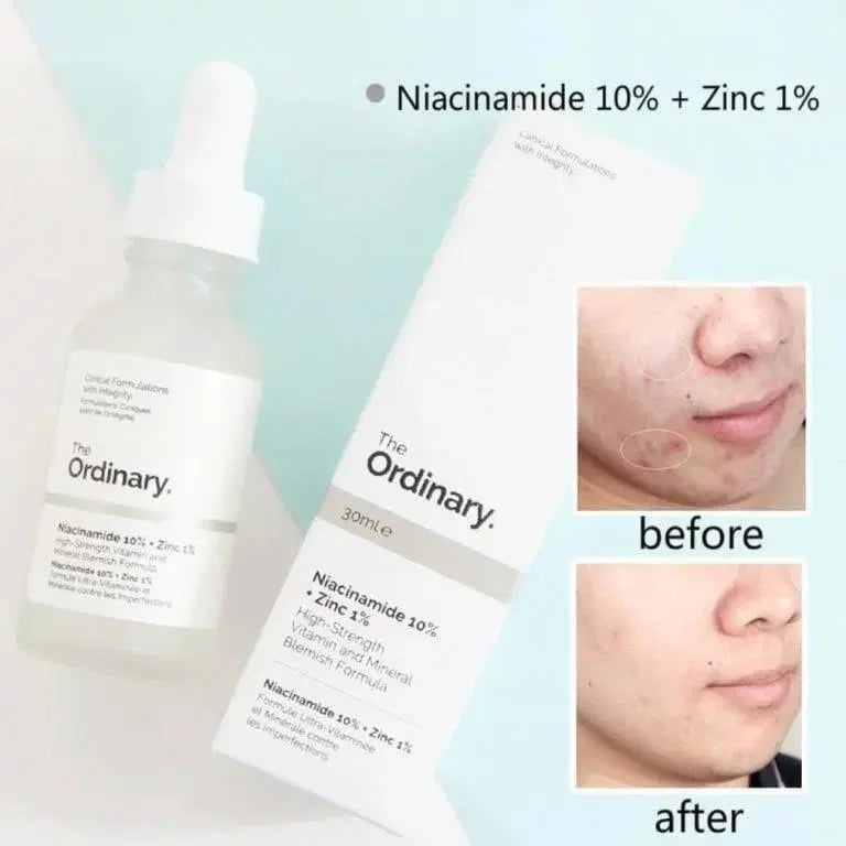The Ordinary Serum - Chaudhary Brand Store 