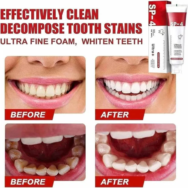 Yayashi SP-4 Ultra Whitening Toothpaste - Chaudhary Brand Store 