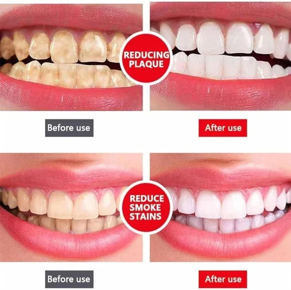 Yayashi SP-4 Ultra Whitening Toothpaste - Chaudhary Brand Store 