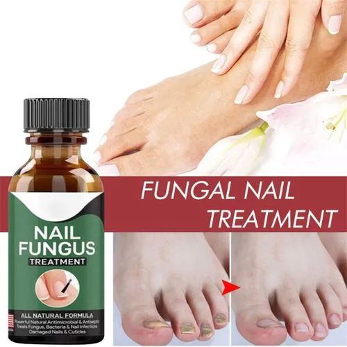 Fast Nail Fungal Treatments Nail Repair Essences Serum Care Treatments Foot Nail Fungus Removal Gel - CHAUDHARY BRAND STORE